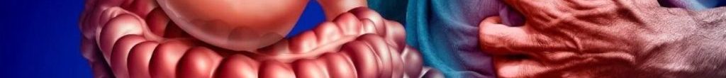 Morbo di Crohn
