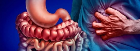 Morbo di Crohn